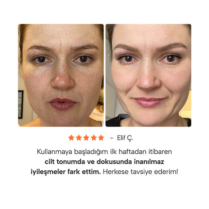 Epify Glutatyon Shot