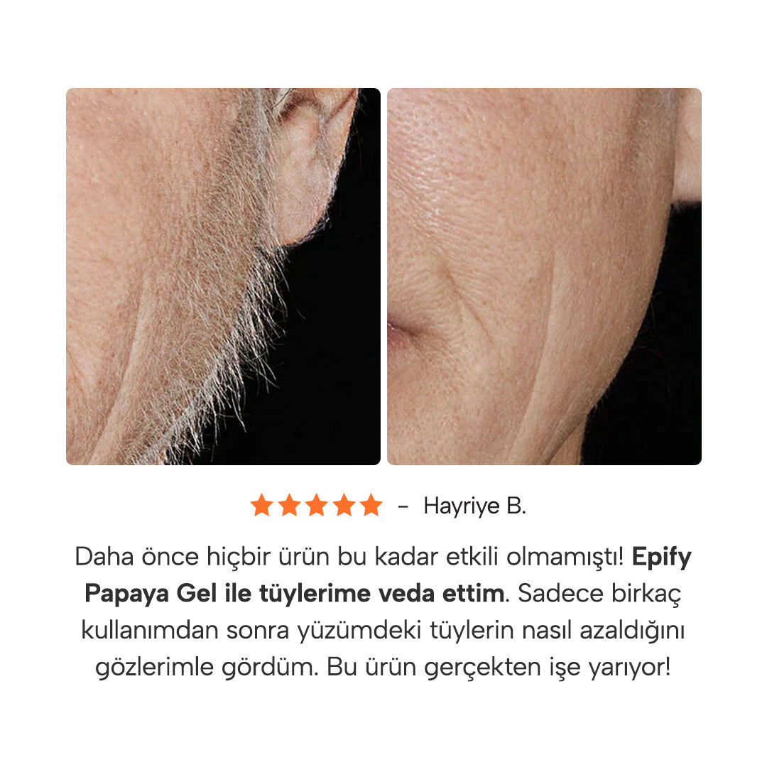 Epify Papaya Gel