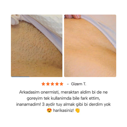 Epify Tüy Dökücü Jel Krem